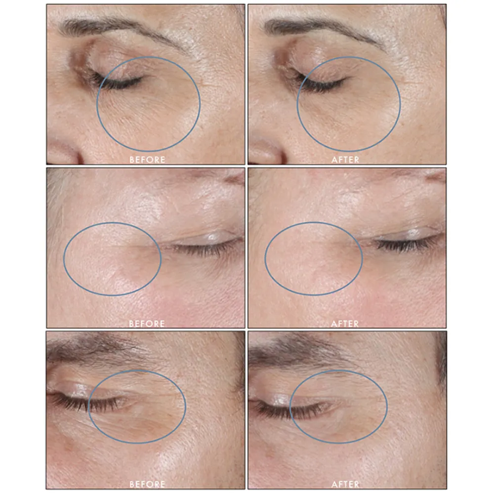 SkinMedica HA5 Rejuvenating Hydrator