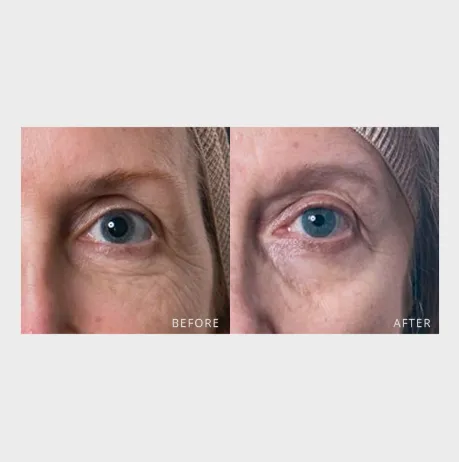 skyn ICELAND Hydro Cool Firming Eye Gels, 8 count