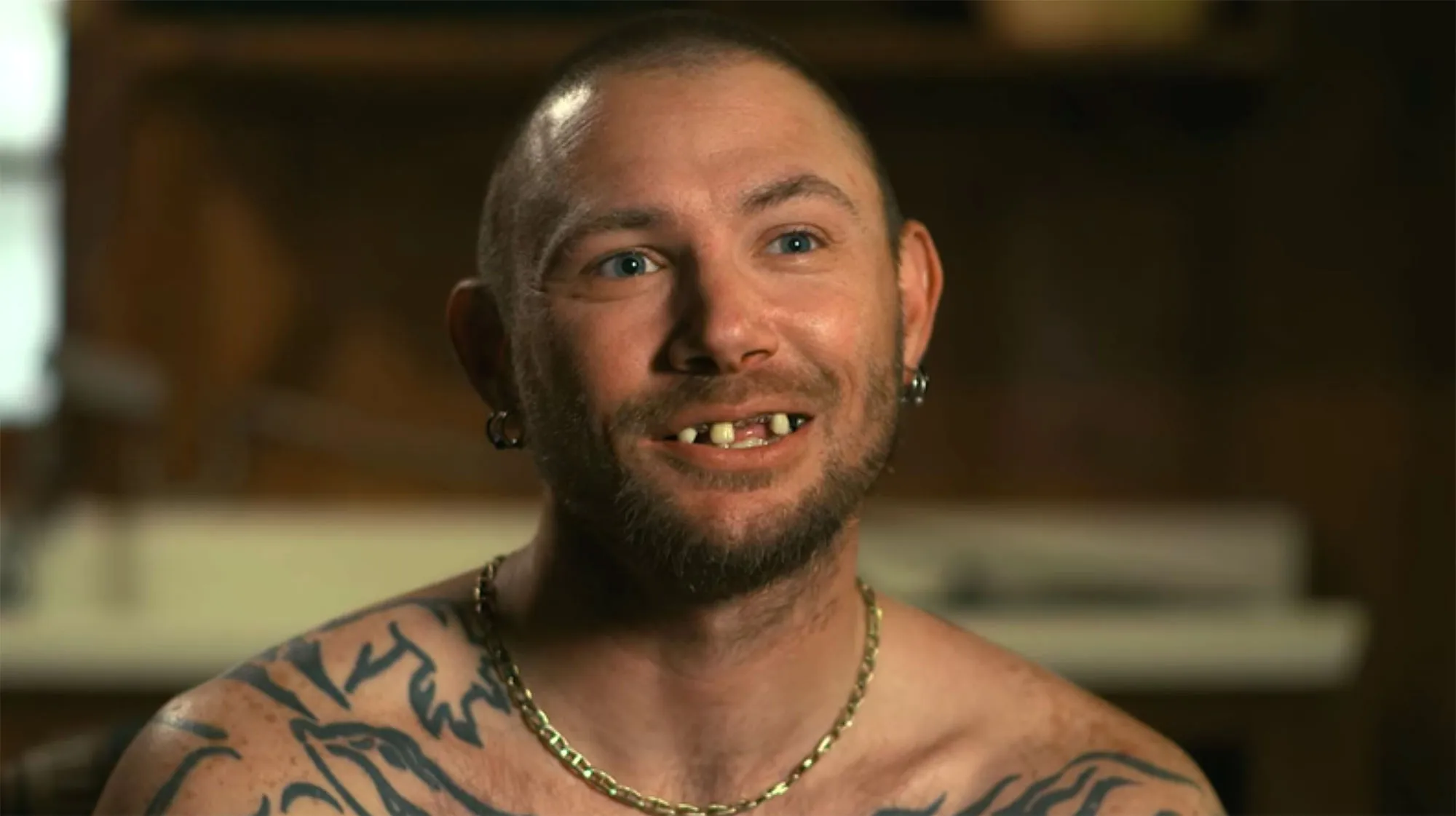 John Finlay before and after new teeth Tiger King 2