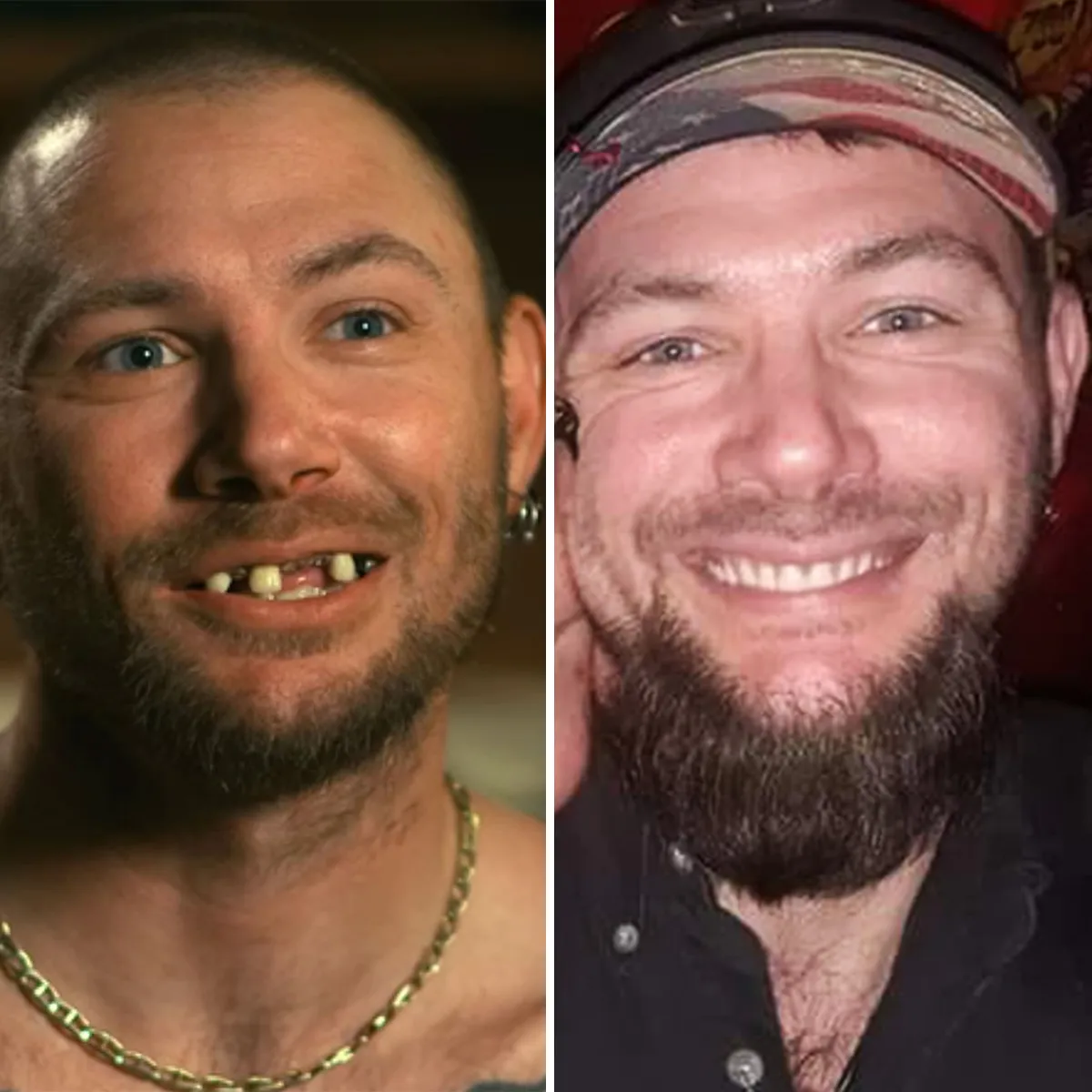 Tiger Kings Doc Antle Says John Finlays Teeth Were Fixed Before Taping