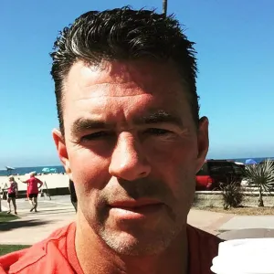 Jim Edmonds Gets Stitches After Losing Fight With His Shower Door