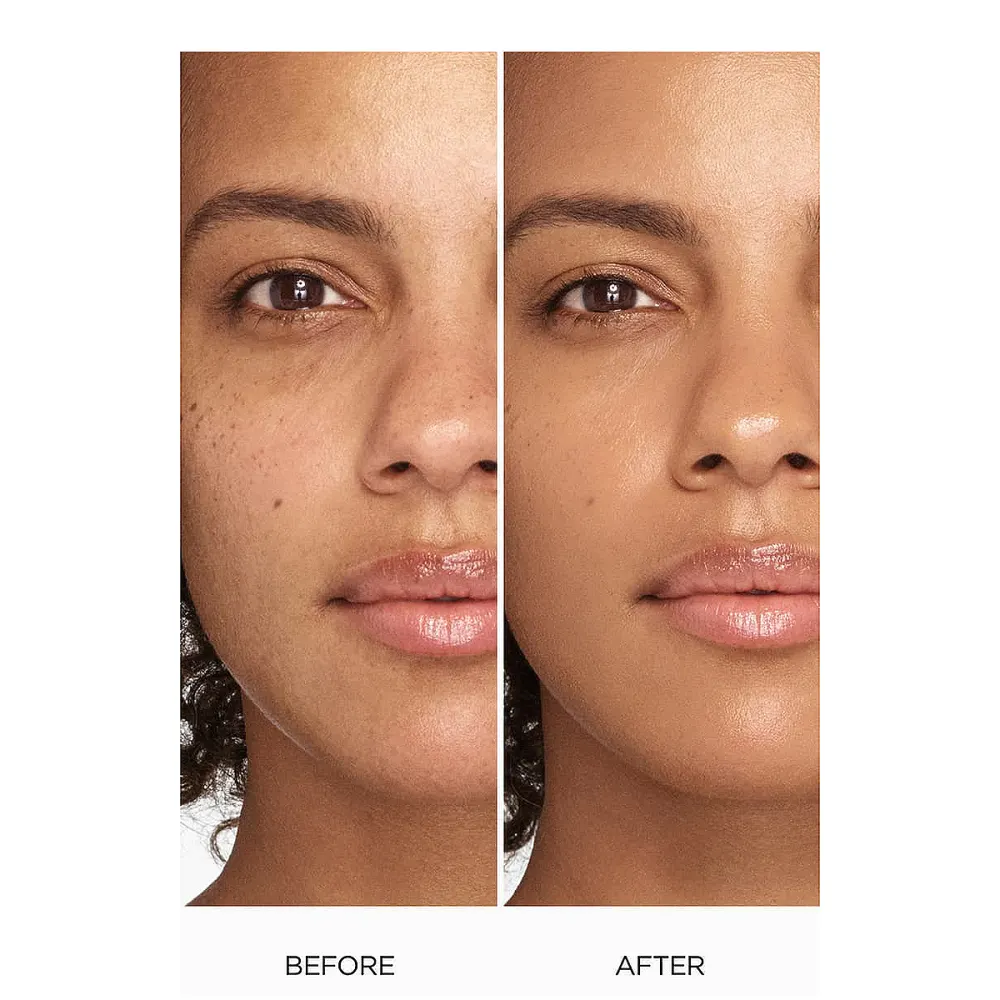 before-after