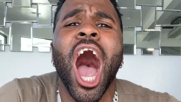 Jason Derulo Appears to Chip His Teeth While Eating Corn on the Cob