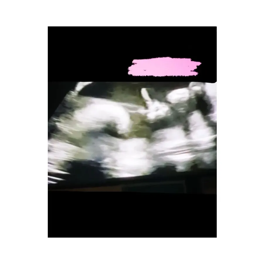 Katy Perry Shares Ultrasound Video of Her and Orlando Bloom Daughter Flipping Them Off