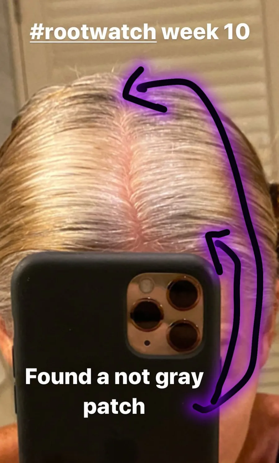 Kelly Ripa Enters 'Week 10' of 'Root Watch' With a Pic to Prove It