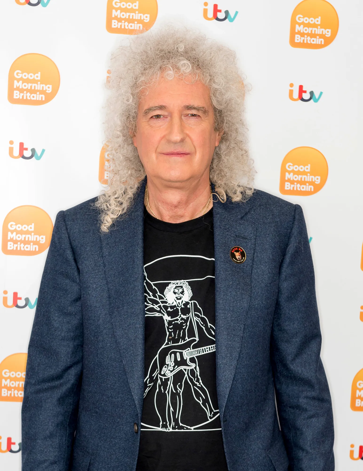 Queen’s Brian May Hospitalized After Ripping His Butt Muscles ‘to Shreds’ While Gardening
