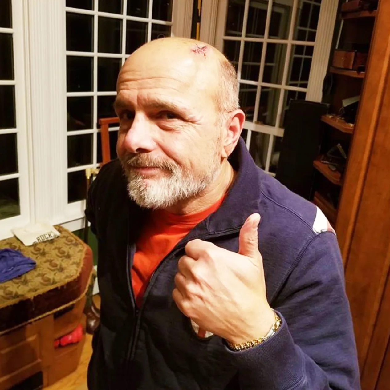 ‘Sopranos’ Alum Joe Pantoliano Sustains ‘Severe Head Injury’ After Being Hit by a Car