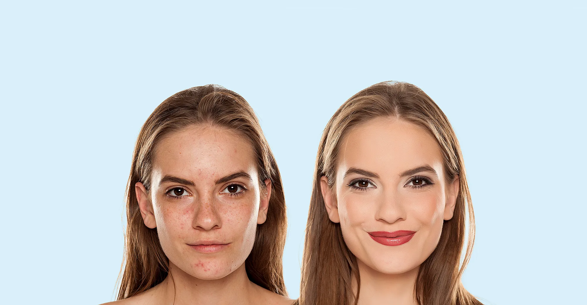 before after beauty nordstrom sale