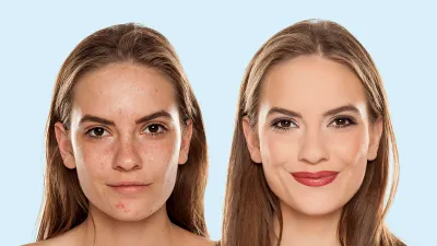 before after beauty nordstrom sale