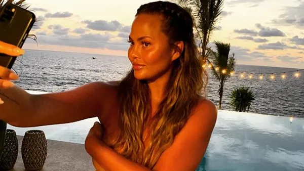 Chrissy Teigen Shares Pic of Breast Implant Removal Surgery and Scars