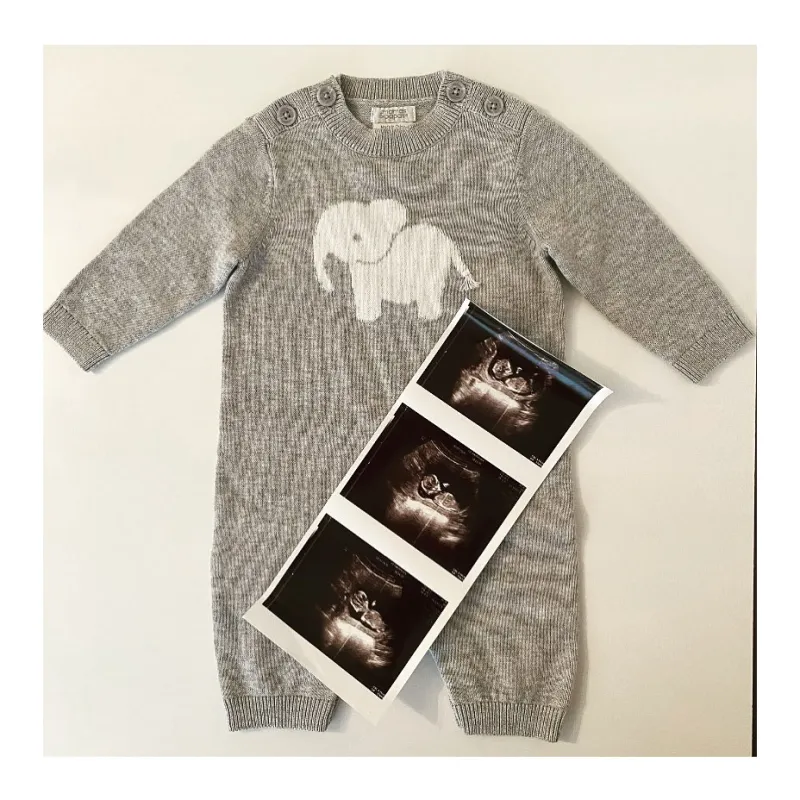 Devon Murray Harry Potter Expecting 1st Child With Girlfriend Shannon McCaffrey Quinn