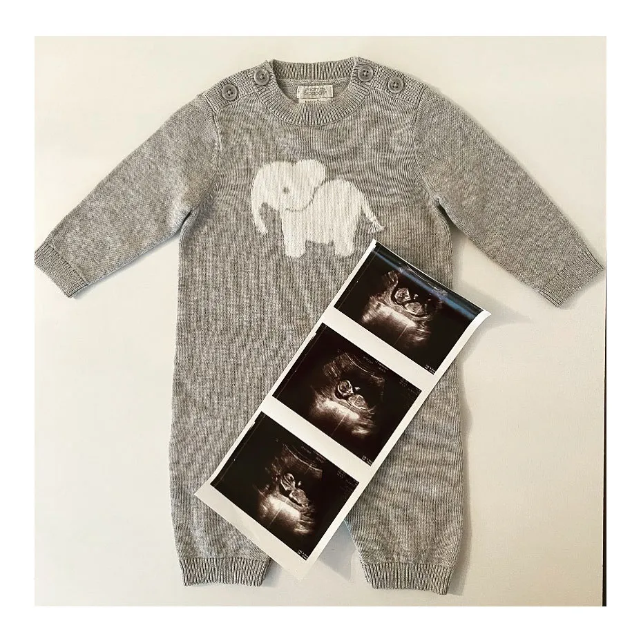 Devon Murray Harry Potter Expecting 1st Child With Girlfriend Shannon McCaffrey Quinn