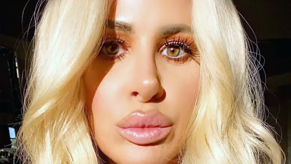 The Evolution of Kim Zolciak’s Beloved Lip Fillers: Pics