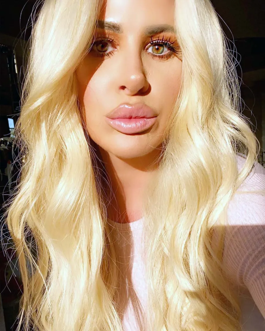 The Evolution of Kim Zolciak’s Beloved Lip Fillers: Pics