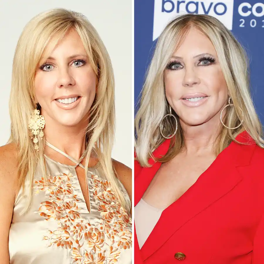 Vicki Gunvalson before and after plastic surgery