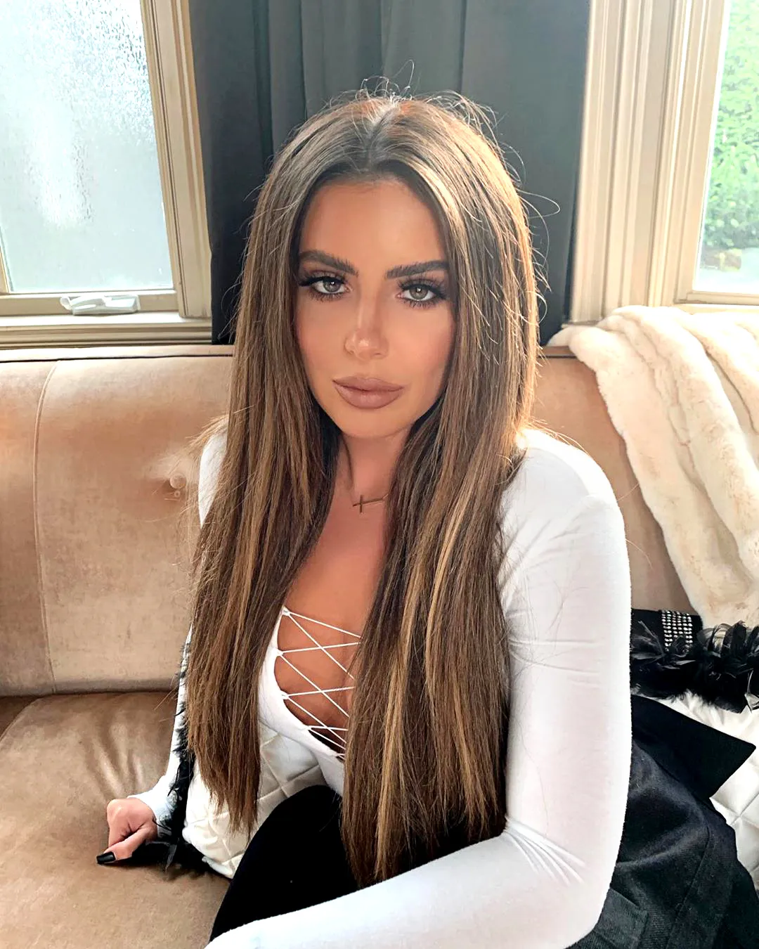 Brielle Biermann Says Dissolving Her Lip Filler Was the ‘Best Thing I Ever Did’