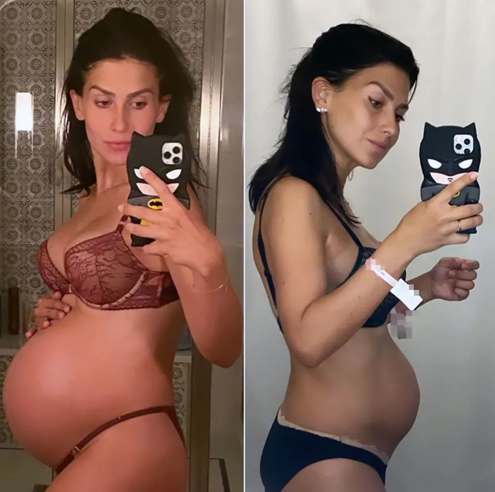 Celebs Show Off Their Postpartum Bodies