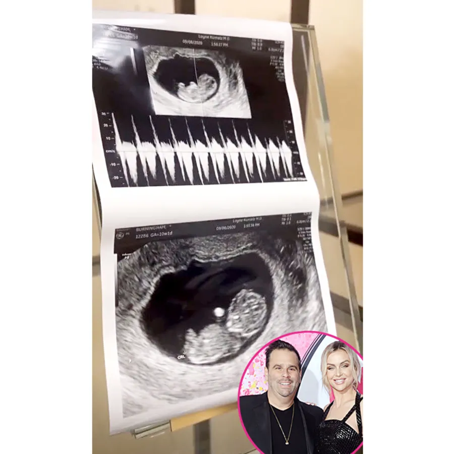 Stars Share Ultrasound Pics Lala Kent Randall Emmett
