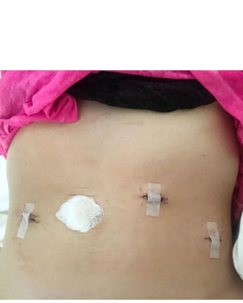 Tara Lipinski Opens Up About Battle With Endometriosis After Laparoscopic Surgery