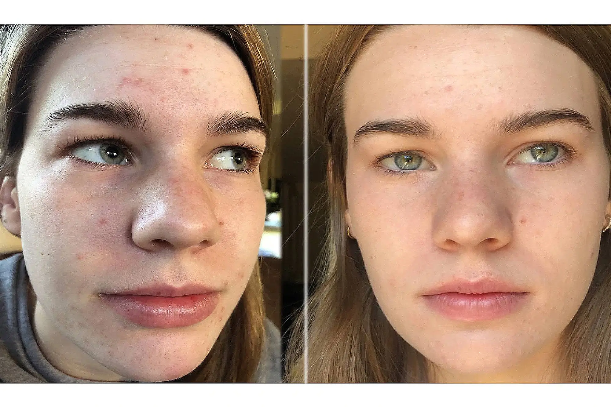 Dr-Zenovia-Skincare-Before-After