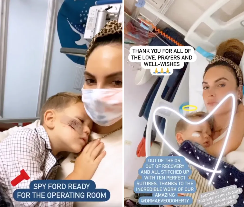 Elizabeth Chambers and Armie Hammer&rsquo;s Son Get 10 Stitches on His Face After Falling Out of Bed