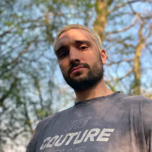 The Wanted’s Tom Parker Reveals His Terminal Brain Tumor Diagnosis