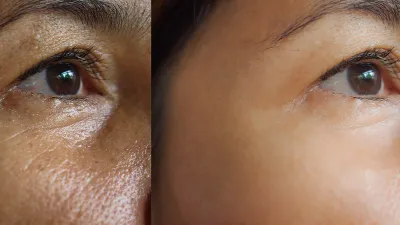 blurring-primer-oily-skin