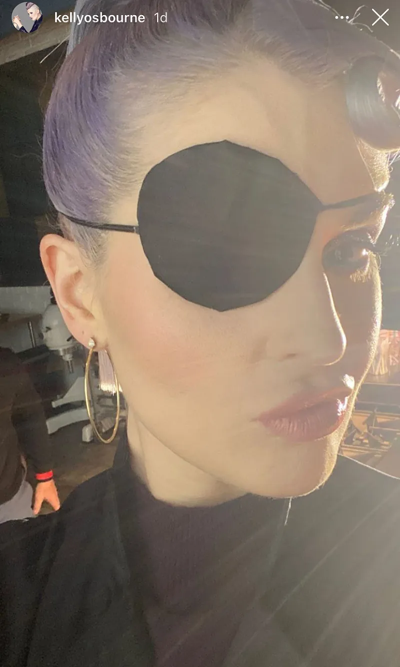 Celebrity Injuries: Kelly Osbourne