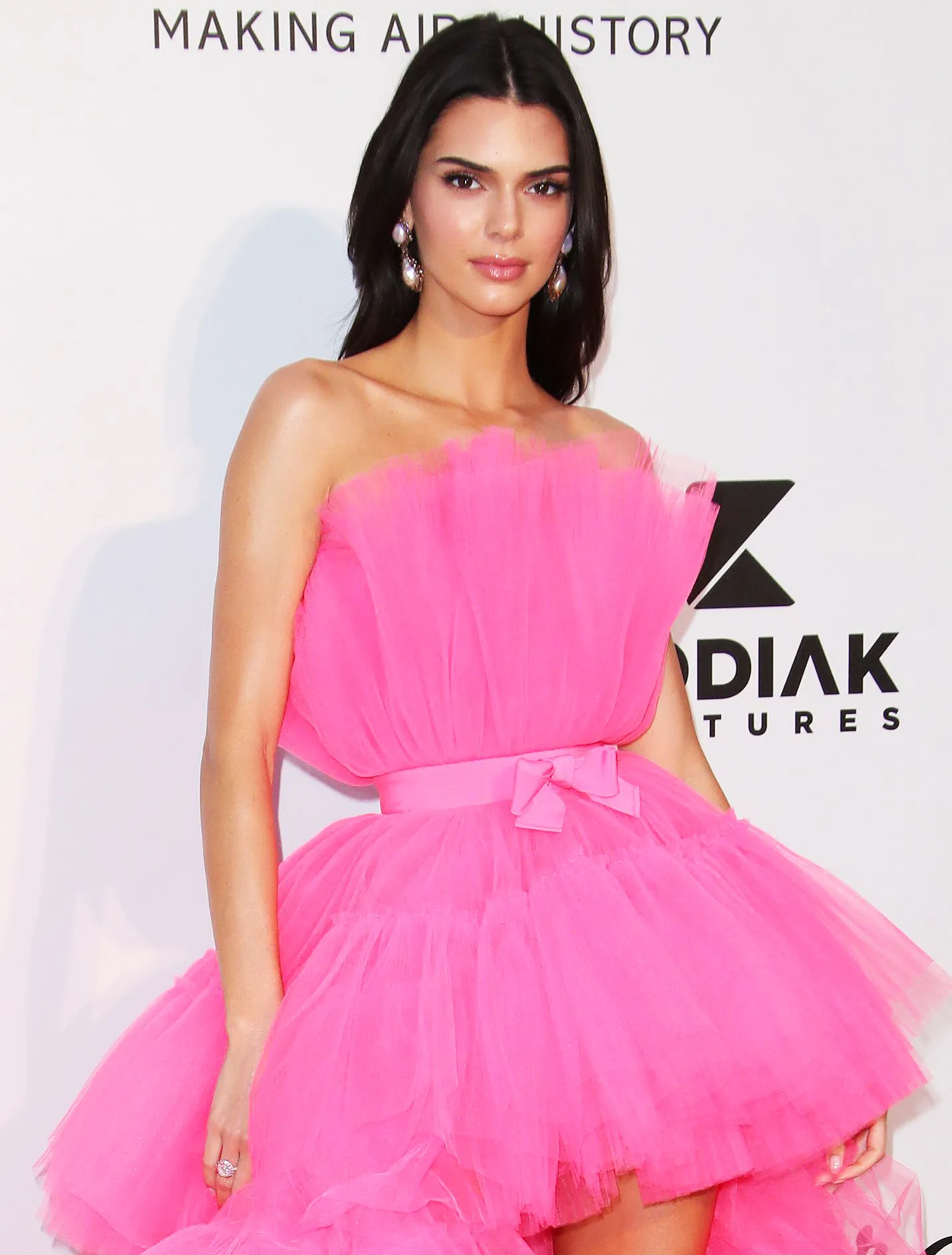 Kendall Jenner Opens Up About Her Struggle With Acne