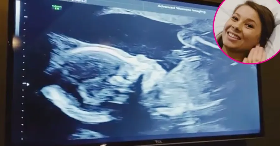 Pregnant Bindi Irwin Shows Beautiful Daughter During Ultrasound Appointment 1