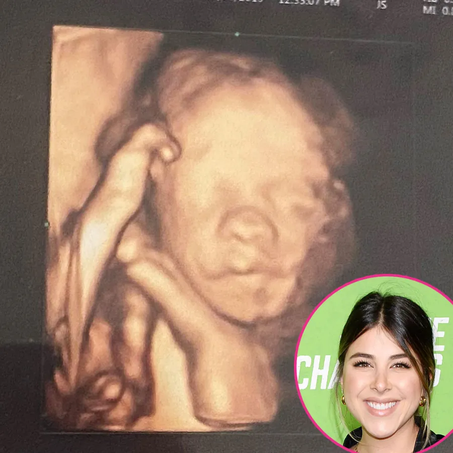 Daniella Monet Ultrasound Pic