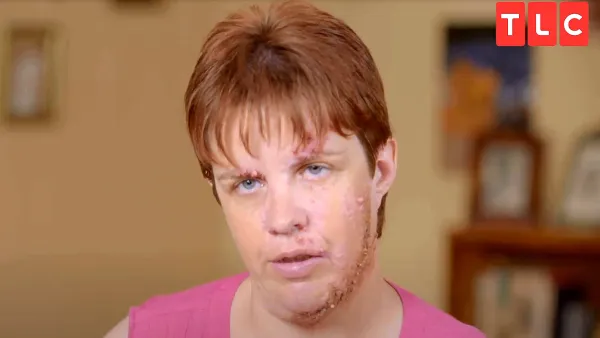 Dr Pimple Popper Sneak Peek Monica Lost Dream Job Due Birthmark