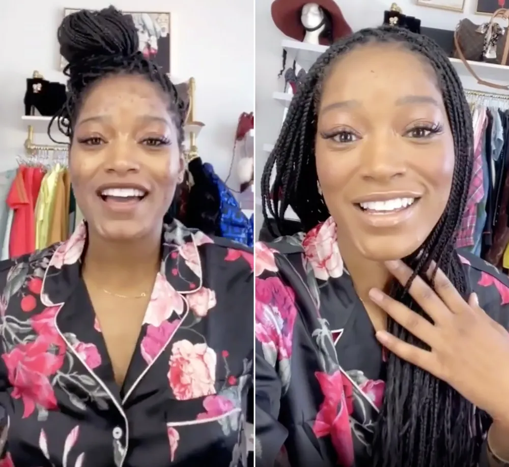 Keke Palmer Shares an 'Extreme Acne Makeup Coverage Tutorial' &mdash; Watch