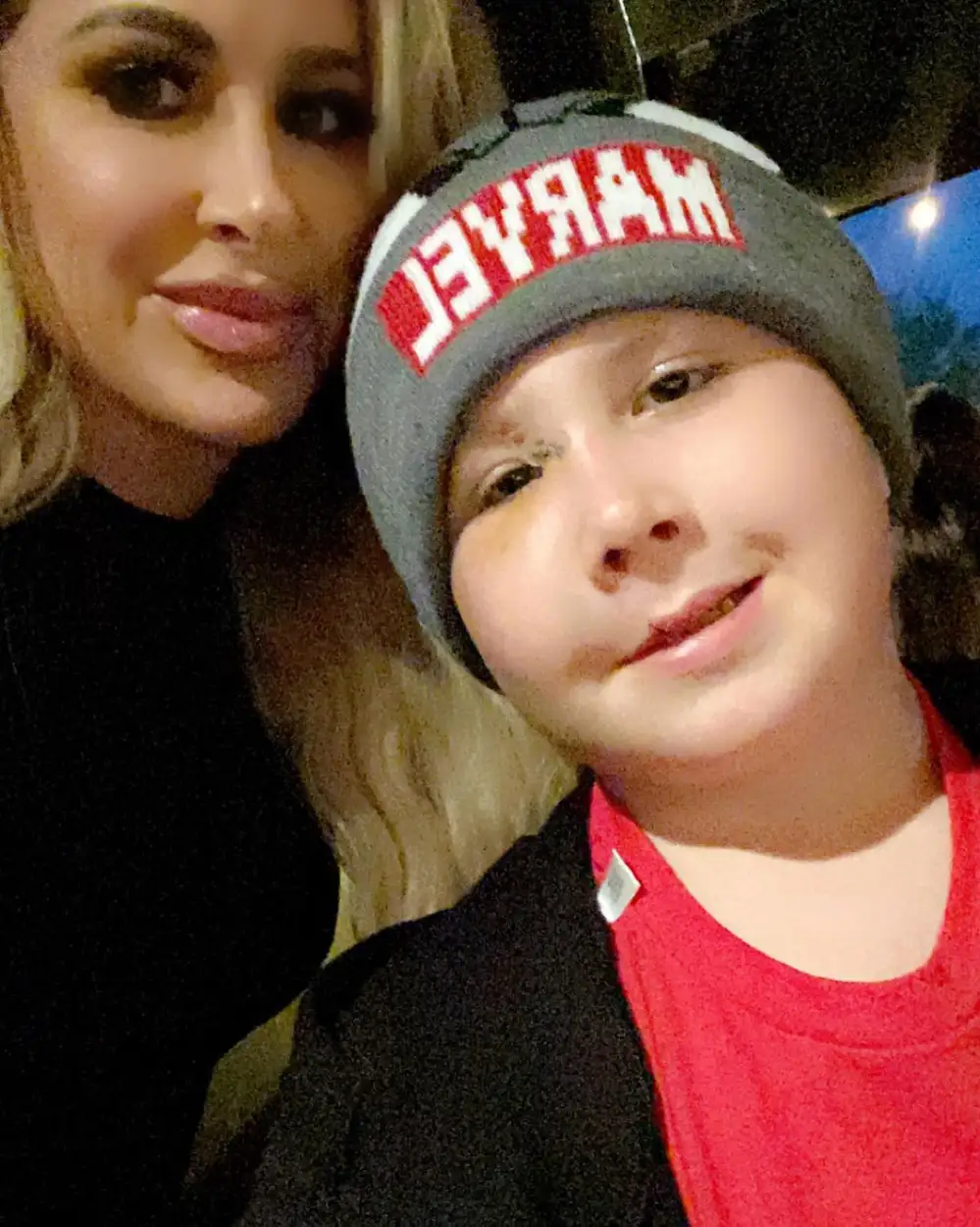 Kim Zolciak Biermann Reveals Son Kash Underwent Reconstructive Surgery 3 Years After Dog Bite Incident: 'Kash is Such a Trooper'