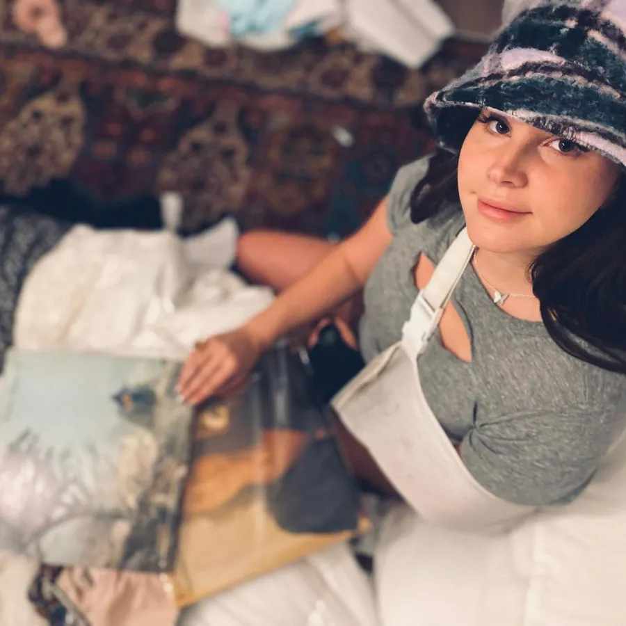 Lana Del Rey Celebrity Injuries