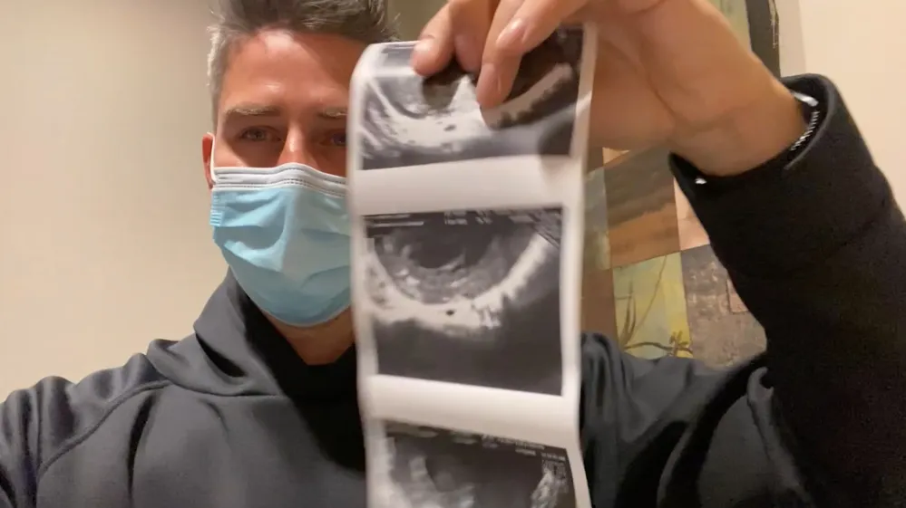 Pregnant Lauren Burnham Arie Luyendyk Jr. Reveal They&rsquo;re Having Twins 1