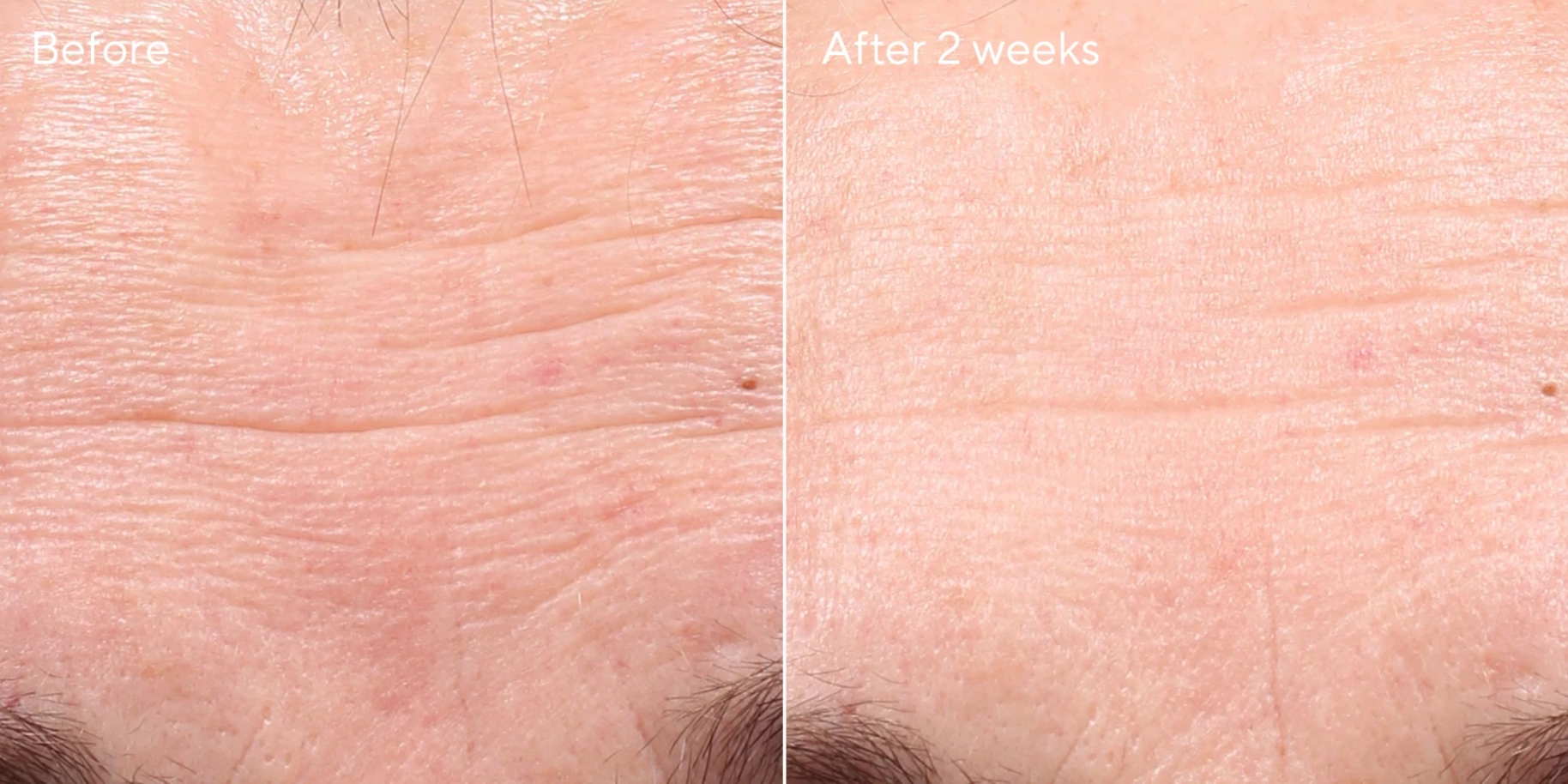 Retinol Youth Renewal Serum