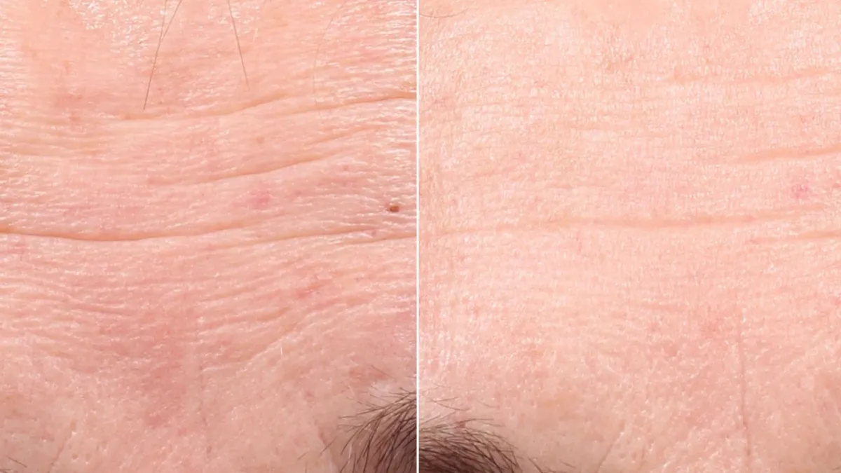 Retinol Youth Renewal Serum