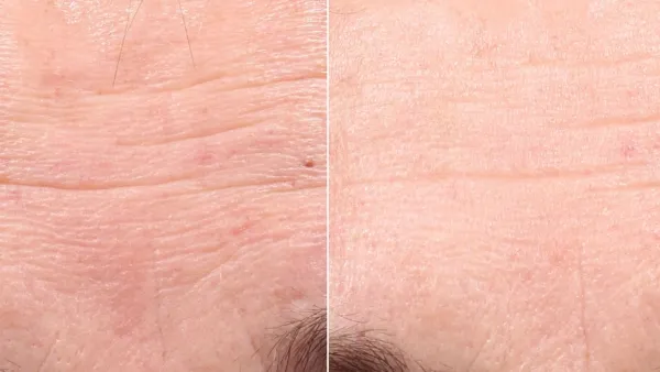 Retinol Youth Renewal Serum