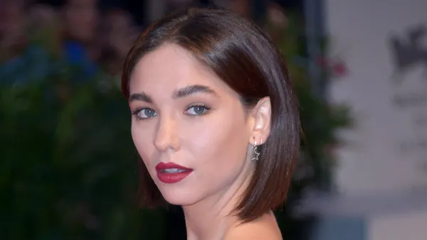 The Undoing's Matilda De Angelis Shares a Pic of Her 'Face Eaten By Acne'