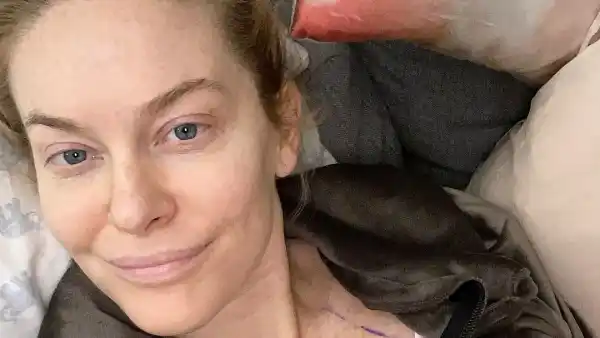 Leah McSweeney Celebs Who Admitted They Got Plastic Surgery