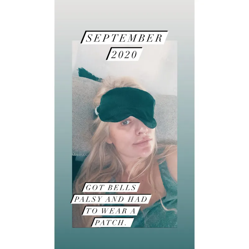 ‘Bachelorette’ Alum Emily Maynard Reveals She Was Diagnosed With Bell’s Palsy While Pregnant With 5th Child