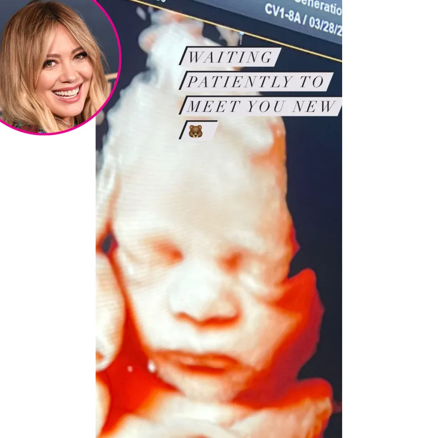 Hilary Duff ultrasound