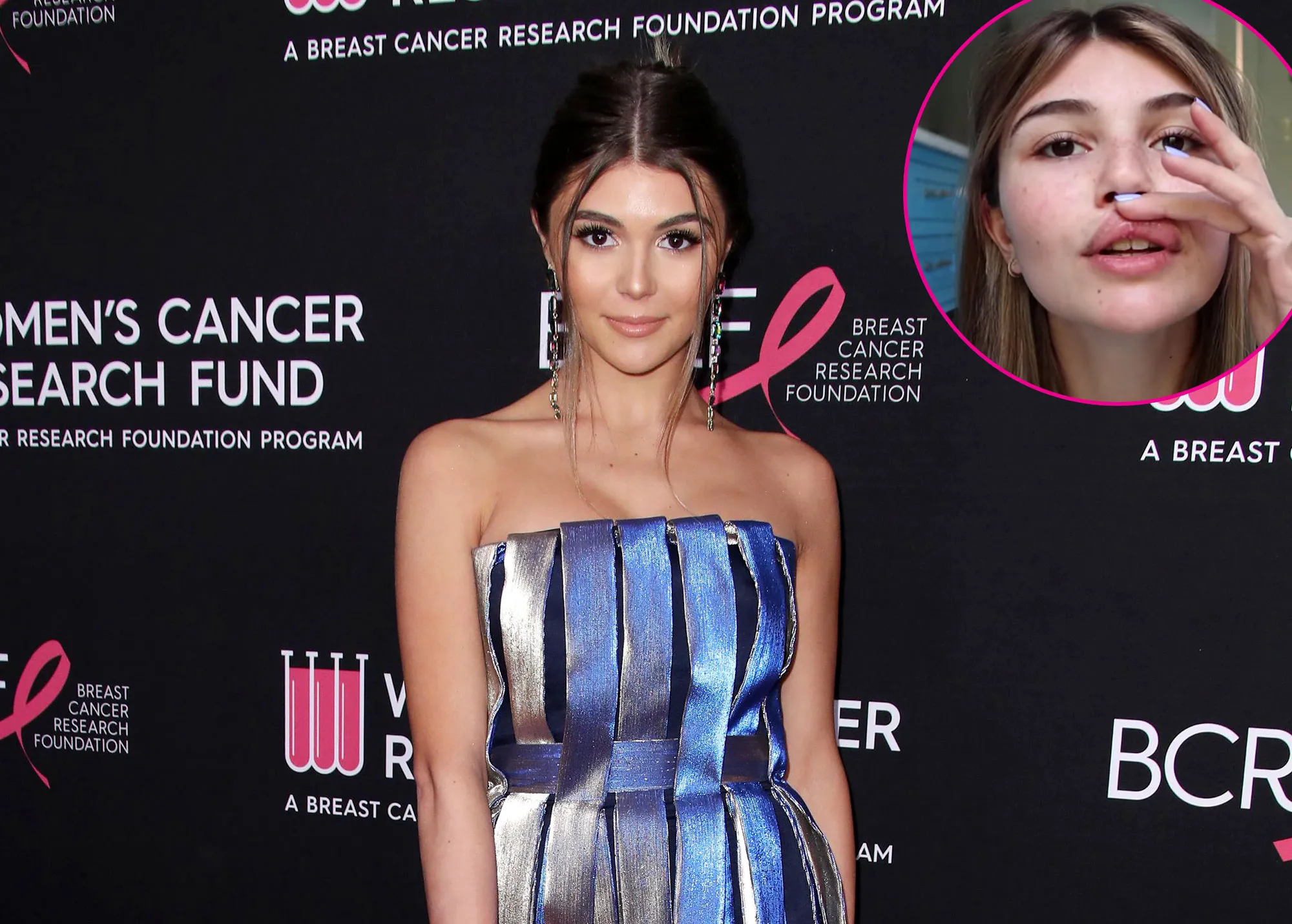 Olivia Jade Shows Off Her Injuries After Fainting Incident