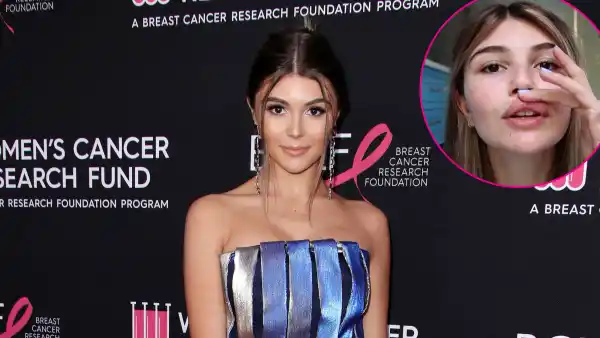 Olivia Jade Shows Off Her Injuries After Fainting Incident
