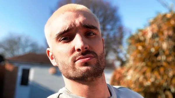 The Wanted Tom Parker Reveals Brain Tumor Significant Reduction