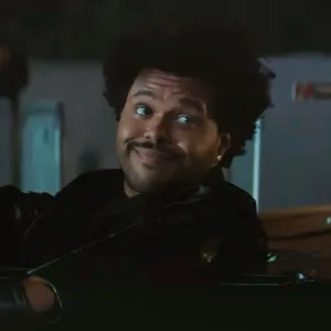 The Weeknd Face Appears Normal After Plastic Surgery Speculation Super Bowl Halftime Performance