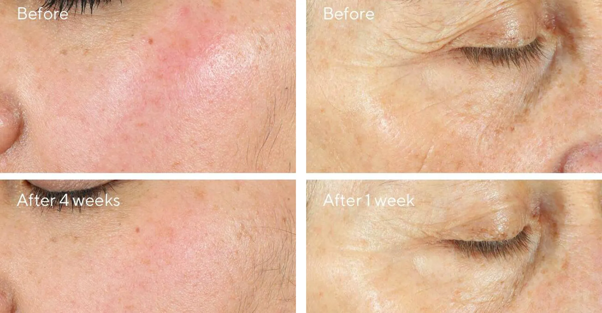 Intense Recovery Cream