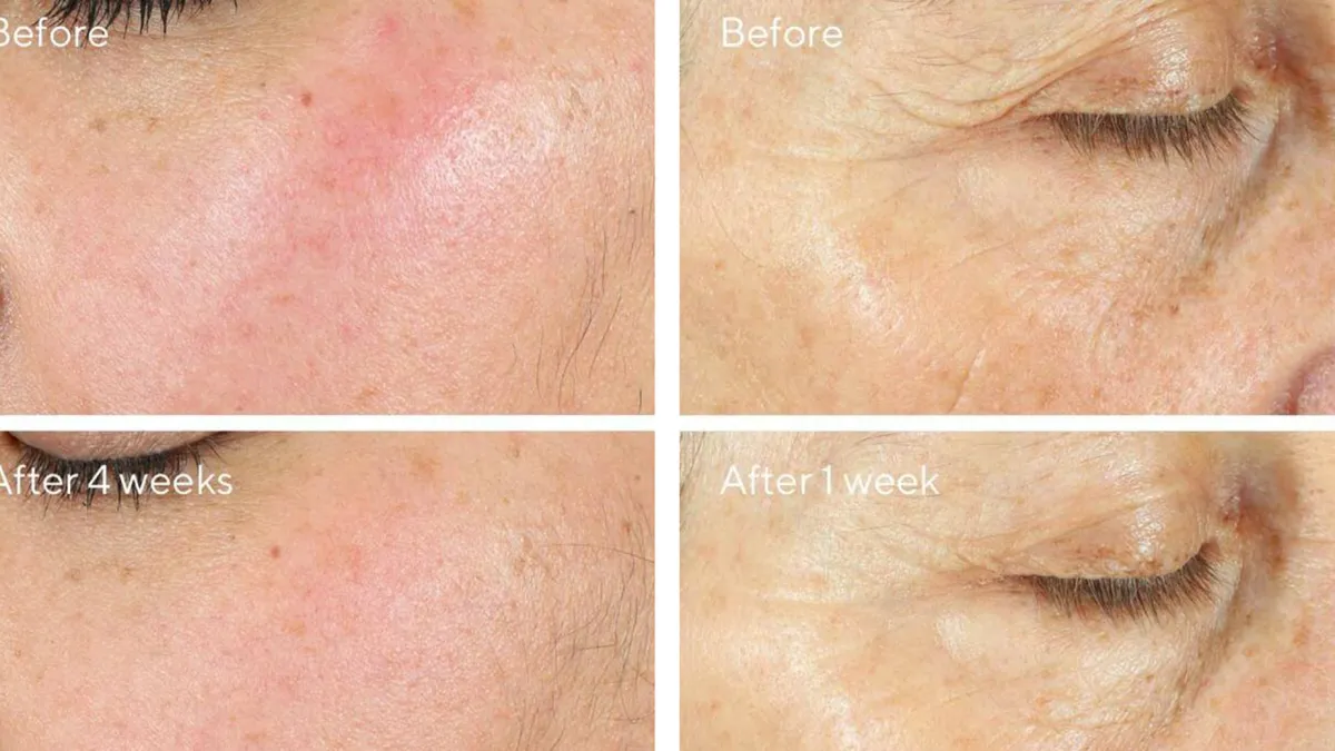 Intense Recovery Cream