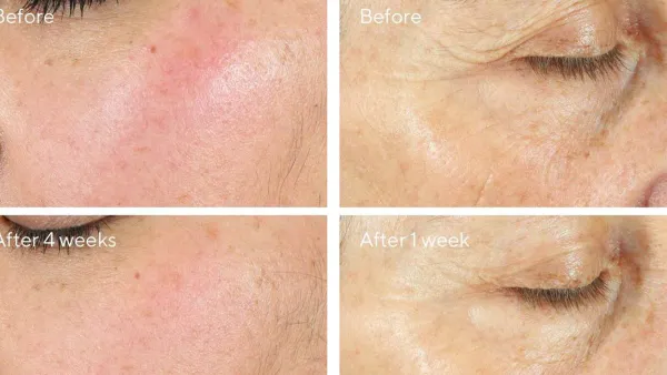 Intense Recovery Cream